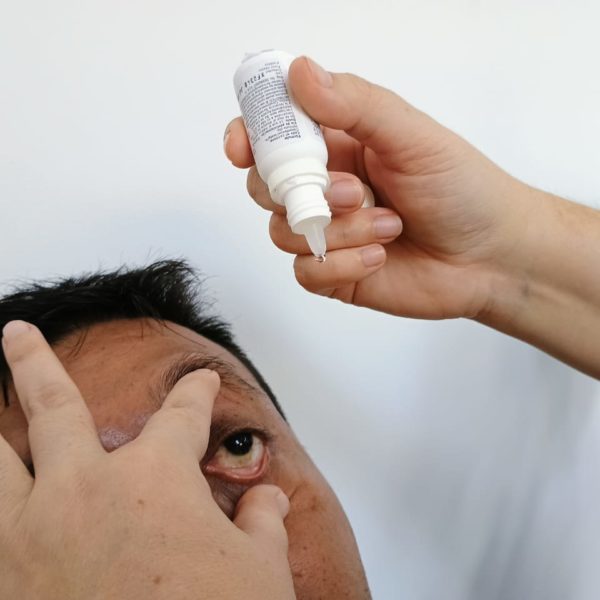 Conjuntivitis